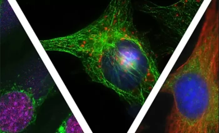 Ένα πρωτότυπο ημερολόγιο γραφείου έχει εκδώσει το Ινστιτούτο Νευρολογίας και Γενετικής Κύπρου (ΙΝΓΚ), για φιλανθρωπικό σκοπό προς ενίσχυση του Telethon.  