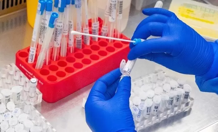 Εργαλείο τεχνητής νοημοσύνης εντοπίζει περισσότερες περιπτώσεις long Covid